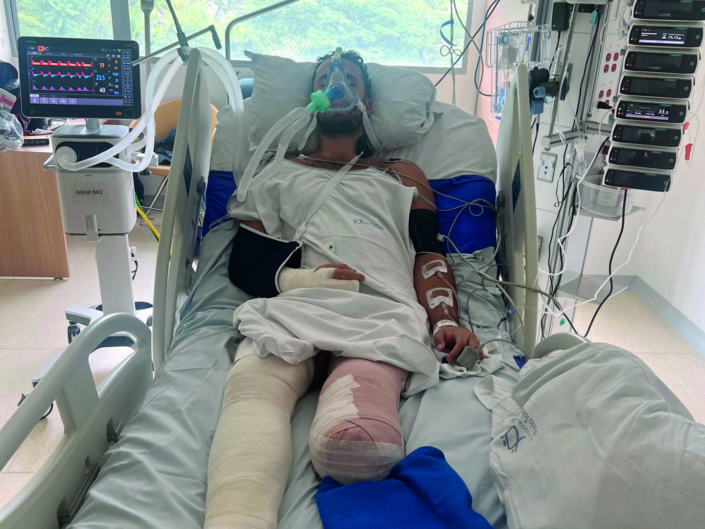 Luke Tarrant lying in a hospital bed with serious injuries, connected to medical equipment and monitors.