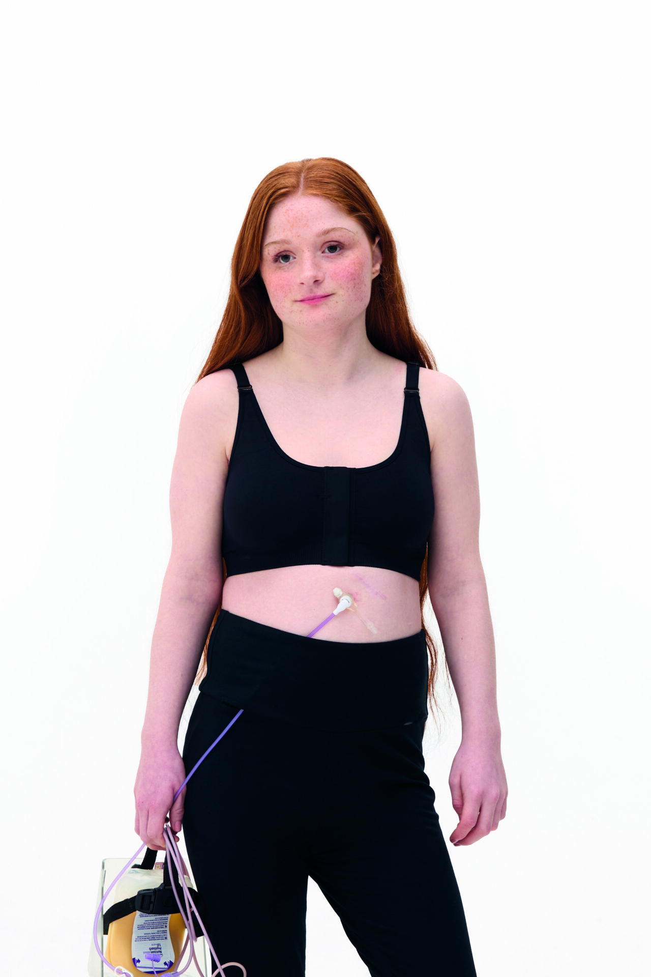 An image of a woman modelling black sportswear. She is has long ginger hair and a medical tubing access point visible at her abdomen, attached to a drainage bag she holds in her right hand.